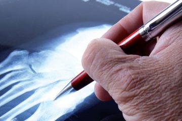 Traumatología